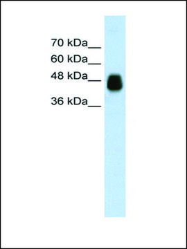 Anti-HOMER1 (AB2) antibody produced in rabbit affinity isolated antibody