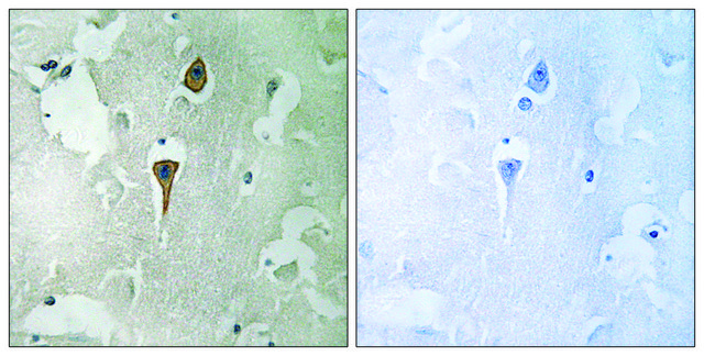 Anti-NMDAR1 antibody produced in rabbit affinity isolated antibody