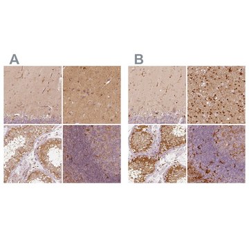 Anti-FSCN1 antibody produced in rabbit Prestige Antibodies&#174; Powered by Atlas Antibodies, affinity isolated antibody