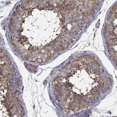 Anti-NME5 antibody produced in rabbit Prestige Antibodies&#174; Powered by Atlas Antibodies, affinity isolated antibody, buffered aqueous glycerol solution
