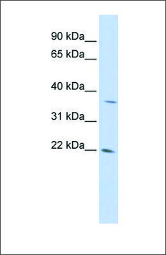 Anti-DDIT4L antibody produced in rabbit affinity isolated antibody