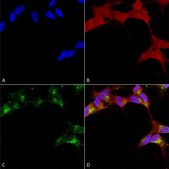 Monoclonal Anti-GABRB3 antibody produced in mouse clone S87-25, 1&#160;mg/mL, purified immunoglobulin