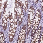 Anti-CDH1 antibody produced in rabbit Prestige Antibodies&#174; Powered by Atlas Antibodies, affinity isolated antibody, buffered aqueous glycerol solution