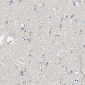 Anti-MYL3 antibody produced in rabbit Prestige Antibodies&#174; Powered by Atlas Antibodies, affinity isolated antibody, buffered aqueous glycerol solution
