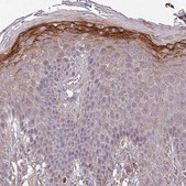 Anti-ISLR antibody produced in rabbit Prestige Antibodies&#174; Powered by Atlas Antibodies, affinity isolated antibody, buffered aqueous glycerol solution