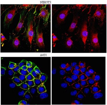 Anti-&#946;-Catenin Antibody from rabbit, purified by affinity chromatography