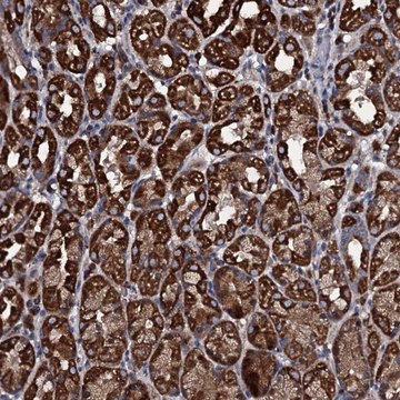 Anti-WDR34 antibody produced in rabbit Prestige Antibodies&#174; Powered by Atlas Antibodies, affinity isolated antibody, buffered aqueous glycerol solution