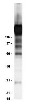 Anti-Phosphotyrosine Antibody, clone 4G10&#174;, agarose conjugate clone 4G10®, Upstate&#174;, from mouse