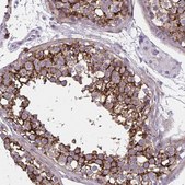 Anti-AKAP12 antibody produced in rabbit Prestige Antibodies&#174; Powered by Atlas Antibodies, affinity isolated antibody, buffered aqueous glycerol solution