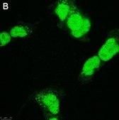 Anti-SOX-11 Antibody, clone 1F16 ZooMAb&#174; Rabbit Monoclonal recombinant, expressed in HEK 293 cells