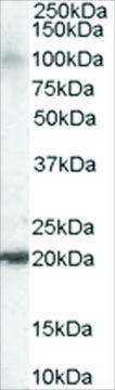 Anti-GTRAP3-18/JWA antibody produced in goat affinity isolated antibody, buffered aqueous solution