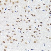 Anti-Cullin 3 antibody produced in rabbit