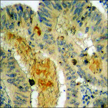 Anti-phospho-IKK-&#946; (pTyr199) antibody produced in rabbit affinity isolated antibody