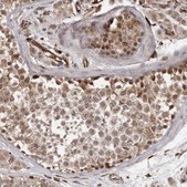 Anti-BRAT1 antibody produced in rabbit Prestige Antibodies&#174; Powered by Atlas Antibodies, affinity isolated antibody, buffered aqueous glycerol solution