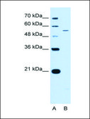 Anti-KCNQ2 (AB2) antibody produced in rabbit affinity isolated antibody