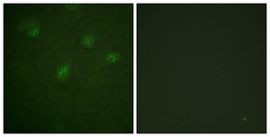 Anti-Estrogen Receptor-&#945;, C-Terminal antibody produced in rabbit affinity isolated antibody
