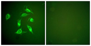 Anti-PDGFR &#945; antibody produced in rabbit affinity isolated antibody