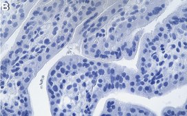 Anti-CD46 Antibody, clone 1C10 ZooMAb&#174; Rabbit Monoclonal recombinant, expressed in HEK 293 cells