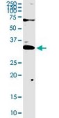 Anti-TREX1 antibody produced in rabbit purified immunoglobulin, buffered aqueous solution
