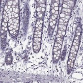 Anti-ALDH3A1 antibody produced in rabbit Prestige Antibodies&#174; Powered by Atlas Antibodies, affinity isolated antibody