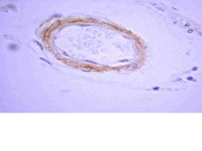 Anti-Beta-Amyloid 1-42 Antibody Chemicon&#174;, from rabbit