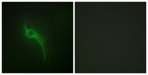 Anti-Collagen V &#945;1 antibody produced in rabbit affinity isolated antibody