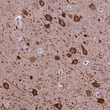 Anti-PIAS3 antibody produced in rabbit Prestige Antibodies&#174; Powered by Atlas Antibodies, affinity isolated antibody, buffered aqueous glycerol solution