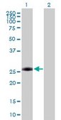 Anti-AAAS antibody produced in rabbit purified immunoglobulin, buffered aqueous solution