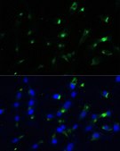 Anti-ENO1 antibody produced in rabbit