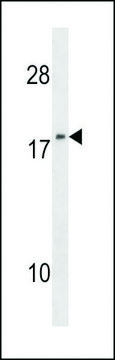 ANTI-NM23 (NME1)(N-TERMINAL) antibody produced in rabbit IgG fraction of antiserum, buffered aqueous solution