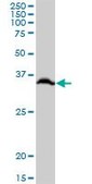 Anti-RPLP0 antibody produced in mouse purified immunoglobulin, buffered aqueous solution