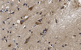 Anti-PKC&#945; Antibody, clone 2H22 ZooMAb&#174; Rabbit Monoclonal recombinant, expressed in HEK 293 cells