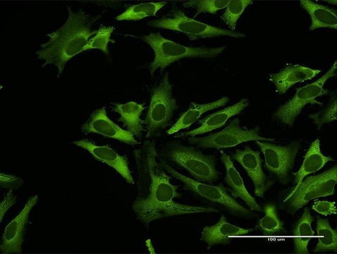 Anti-RARS antibody produced in rabbit purified immunoglobulin, buffered aqueous solution