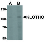 Anti-KLOTHO antibody produced in rabbit affinity isolated antibody, buffered aqueous solution