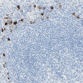 Anti-IL6ST antibody produced in rabbit Prestige Antibodies&#174; Powered by Atlas Antibodies, affinity isolated antibody, buffered aqueous glycerol solution
