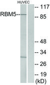 Anti-RBM5 antibody produced in rabbit affinity isolated antibody
