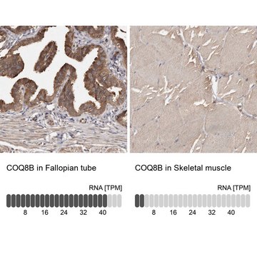 Anti-COQ8B antibody produced in rabbit Prestige Antibodies&#174; Powered by Atlas Antibodies, affinity isolated antibody, buffered aqueous glycerol solution, ab3