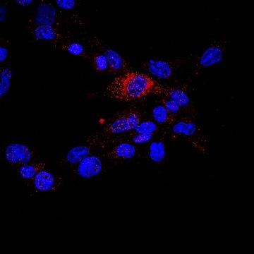 Anti-TIMP-3 Antibody, CT from rabbit, purified by affinity chromatography