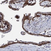 Anti-MPP1 antibody produced in rabbit Prestige Antibodies&#174; Powered by Atlas Antibodies, affinity isolated antibody, buffered aqueous glycerol solution