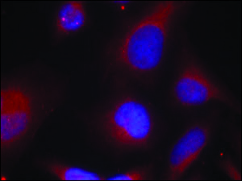 Anti-phospho-MARCKS (pSer158) antibody produced in rabbit affinity isolated antibody