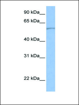 Anti-SLC22A11 (AB1) antibody produced in rabbit affinity isolated antibody