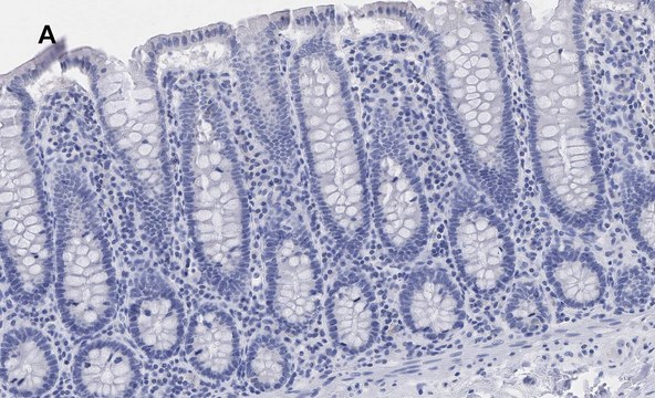 Anti-BRG1 Antibody, clone 1N12, ZooMAb&#174; Rabbit Monoclonal recombinant, expressed in HEK 293 cells