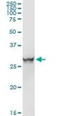 Anti-ORM1 antibody produced in rabbit purified immunoglobulin, buffered aqueous solution