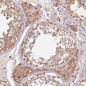 Anti-ADH5 antibody produced in rabbit Prestige Antibodies&#174; Powered by Atlas Antibodies, affinity isolated antibody, buffered aqueous glycerol solution