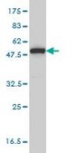 Monoclonal Anti-MPP1 antibody produced in mouse clone 1C3-1D11, purified immunoglobulin, buffered aqueous solution