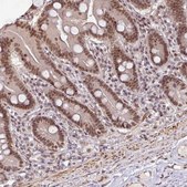 Anti-SRSF2 antibody produced in rabbit Prestige Antibodies&#174; Powered by Atlas Antibodies, affinity isolated antibody, buffered aqueous glycerol solution