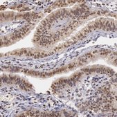 Anti-SOD1 antibody produced in rabbit Prestige Antibodies&#174; Powered by Atlas Antibodies, affinity isolated antibody, buffered aqueous glycerol solution
