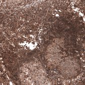 Anti-TRIM21 antibody produced in rabbit Prestige Antibodies&#174; Powered by Atlas Antibodies, affinity isolated antibody, buffered aqueous glycerol solution