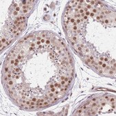 Anti-TCF20 antibody produced in rabbit Prestige Antibodies&#174; Powered by Atlas Antibodies, affinity isolated antibody, buffered aqueous glycerol solution