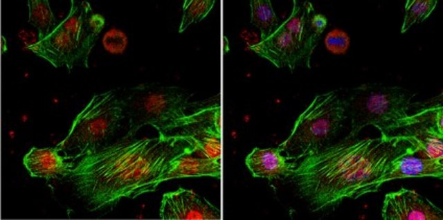 Anti-TLS Antibody, clone 1FU-1D2 ascites fluid, clone 1FU-1D2, from mouse